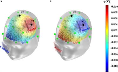 Effects of Transcranial Direct Current Stimulation Over the Left Primary Motor Cortex on Verbal Intelligence